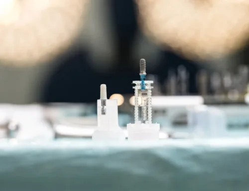 Was ist ein Zahnimplantat?